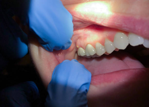 Best Pediatric Emergency Dentist in Lorena, TX