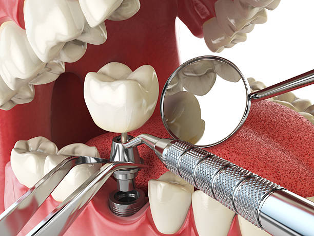 Best Mobile Emergency Dentist in Lorena, TX